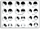hair_loss_1